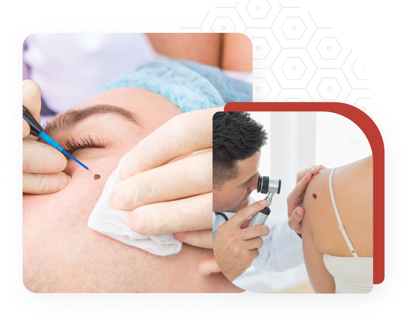 doctor treating skin care patient