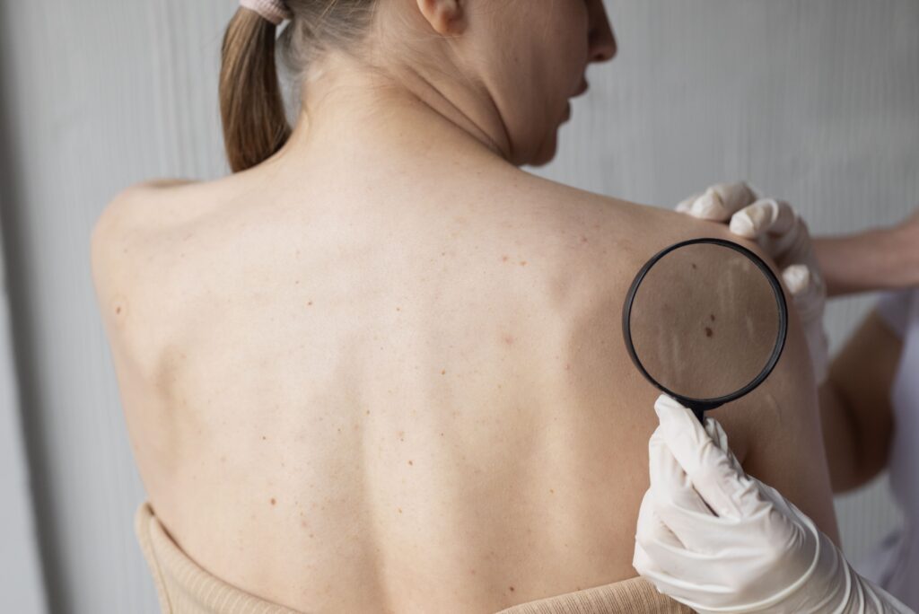 Early Signs of Skin Cancer
